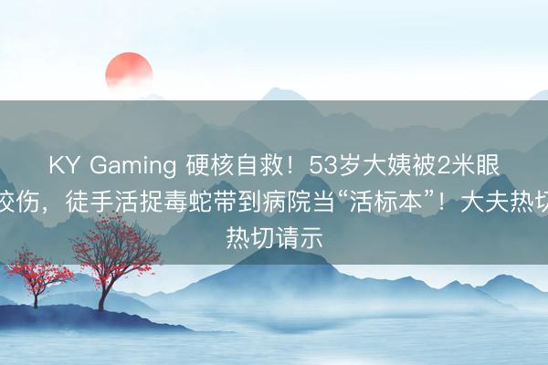 KY Gaming 硬核自救！53岁大姨被2米眼镜蛇咬伤，徒手活捉毒蛇带到病院当“活标本”！大夫热切请示